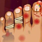 Постер игры Монстр Foot Doctor | Monster Foot Doctor