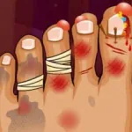 Постер Монстр Foot Doctor | Monster Foot Doctor