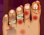 Игра Монстр Foot Doctor | Monster Foot Doctor