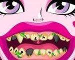 Дракула Плохие Зубы  | Draculaura Bad Teeth