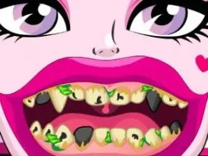 Игра Дракула Плохие Зубы  | Draculaura Bad Teeth