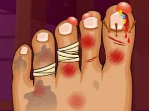 Игра Монстр Foot Doctor | Monster Foot Doctor