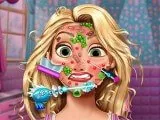 Игра Голди Принцесса Кожи Доктор | Goldie Princess Skin Doctor