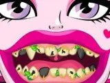 Игра Дракула Плохие Зубы  | Draculaura Bad Teeth