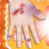 Игра Маленькие Проблемы с Ногтями