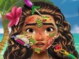 Игра Моана Кожный Доктор